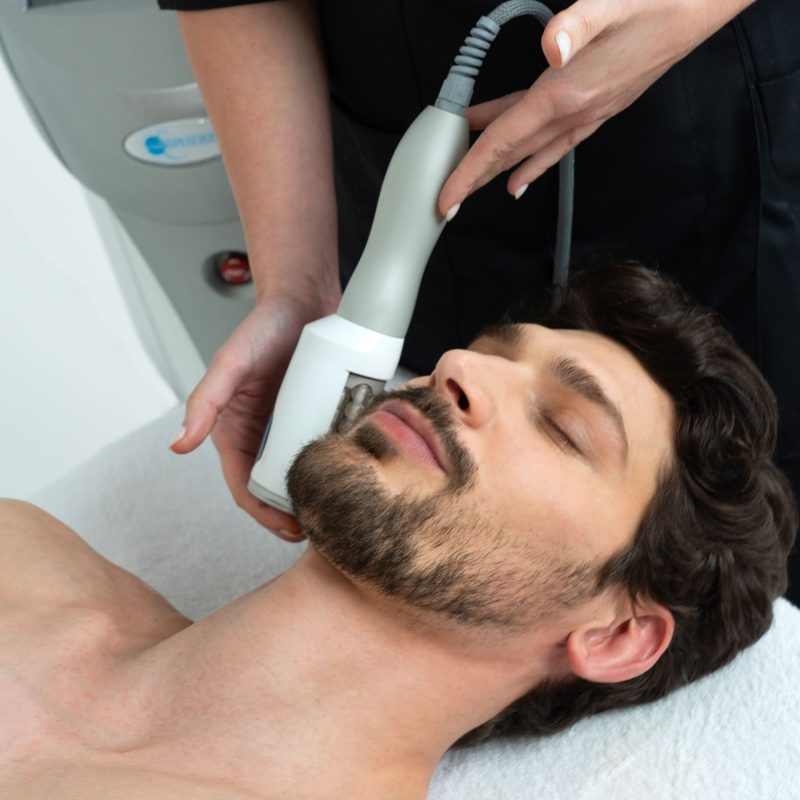 Men's Endosphere Face Sculpting Treatment